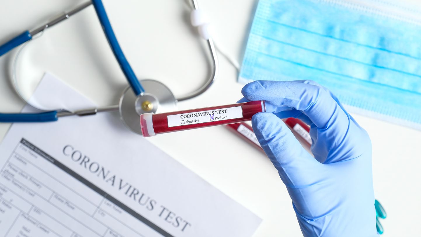 Arst koroonaviiruse testiga, mis on positiivne ehk näitab nakatumist.