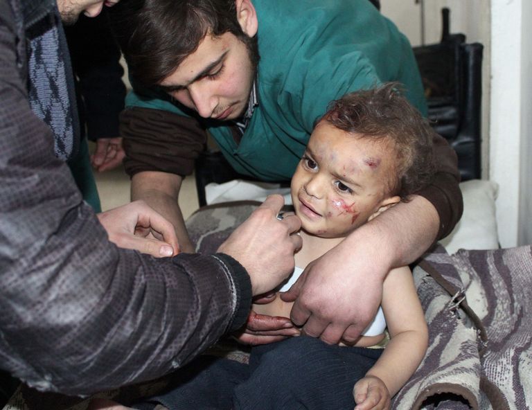 Režiimivägede kobarpommirünnakus haavata saanud Süüria laps Damaskuses.