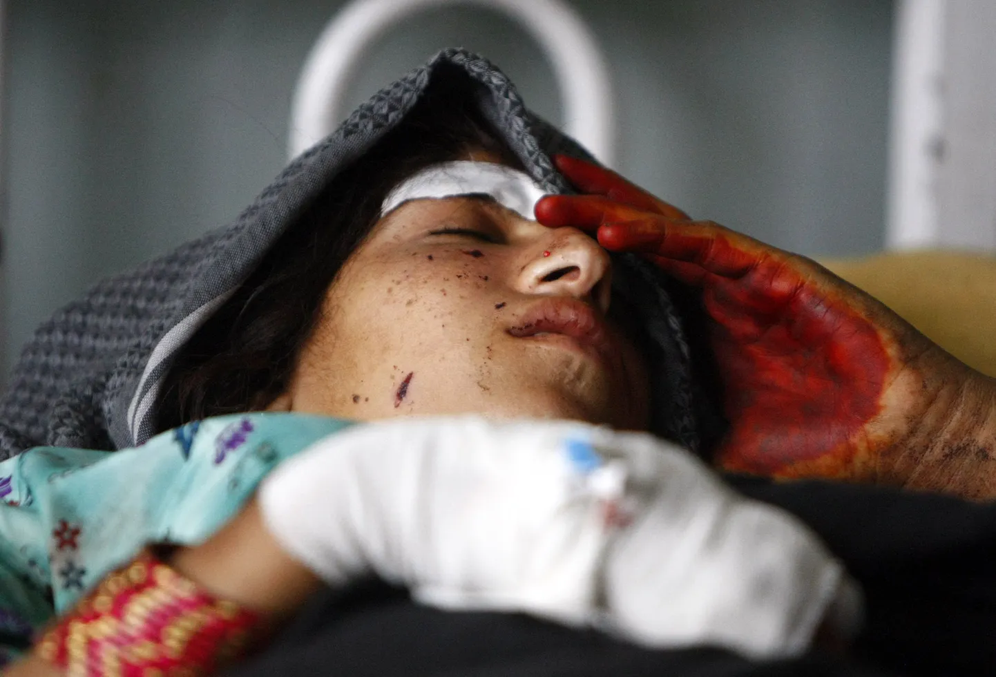 Laghmani provintsis aset leidnud NATO rünnakus vigastada saanud naine.