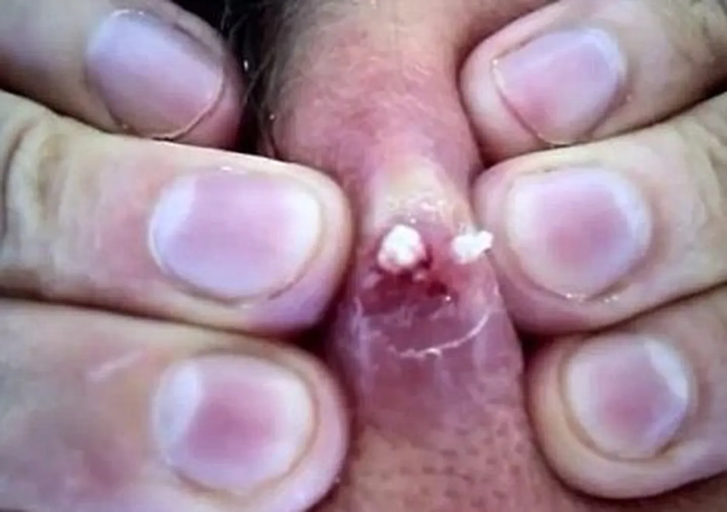 Punni pigistamine