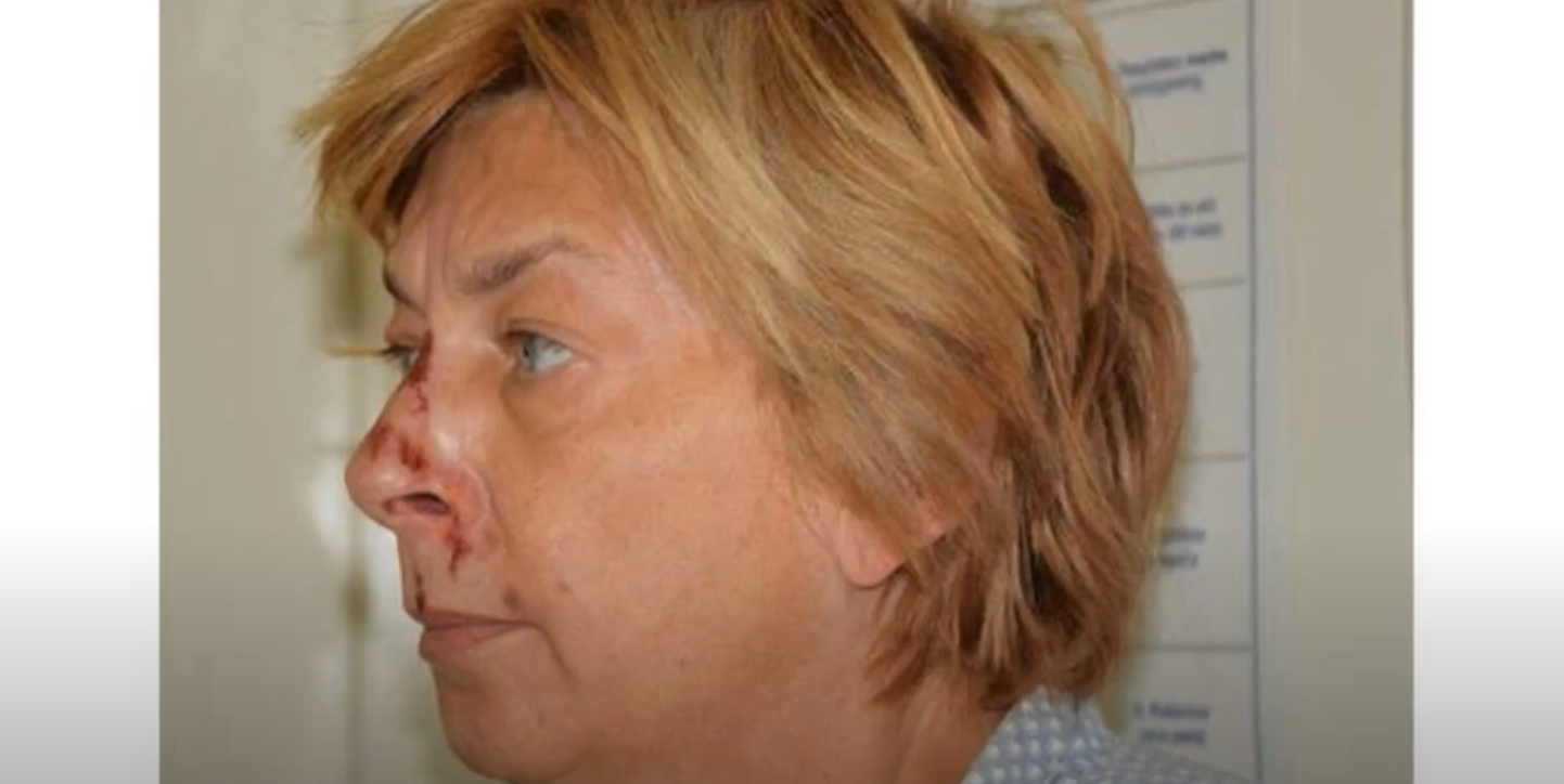 Horvaatia Krki saarelt leiti vigastatud naine, kes ei mäleta oma nime ega seda, kuidas ta sinna sattus
