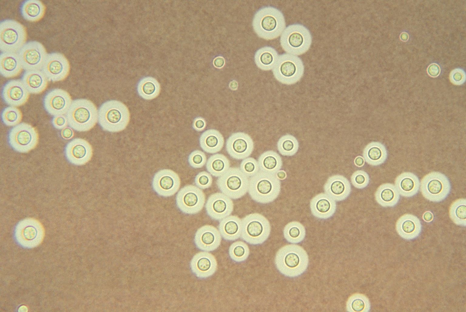 Гриб cryptococcus neoformans