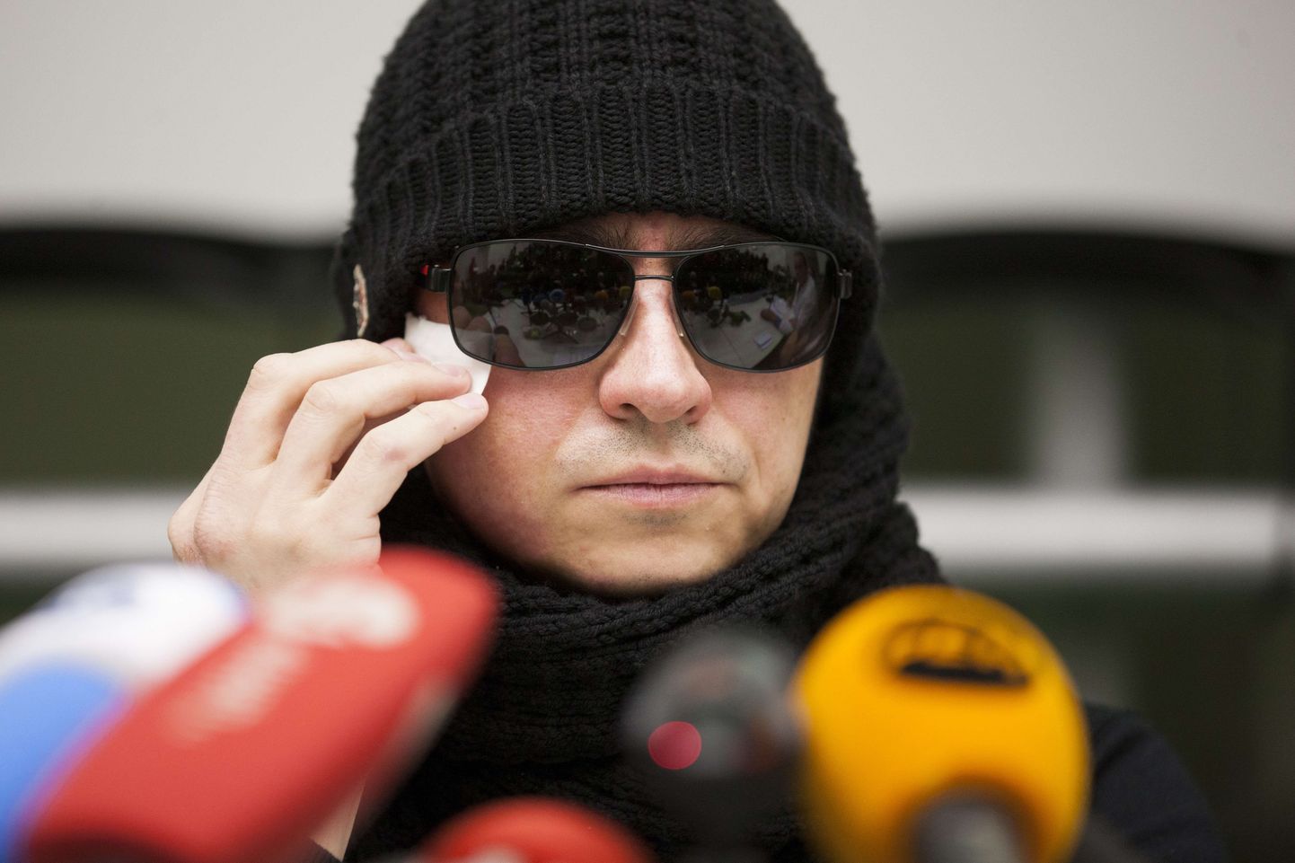 Sergei Filins, the Bolshoi ballet's chief, wears sunglasses and a cap as he attends a press conference at the University Hospital of Aachen on March 15, 2013 in Aachen, western Germany, where he is being treated after an acid attack.
Bolshoi artistic director Sergei Filin, who suffered serious eye damage and facial disfigurement in a horrific acid attack, will be able to recover enough vision to return to work, a German doctor treating him said Friday, March 15, 2013. AFP PHOTO /ROLF VENNENBERND  GERMANY OUT