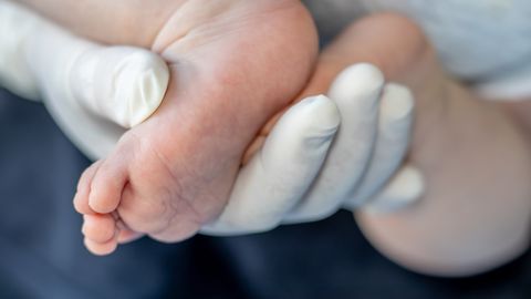 Surmahaigust sõeluv beebide uuring peab endiselt lootma annetajate heldusele