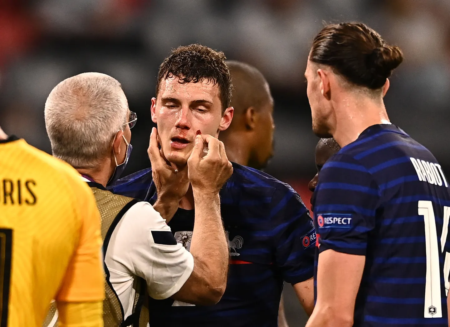Arstid turgutasid Benjamin Pavard'i mängukõlbulikuks.