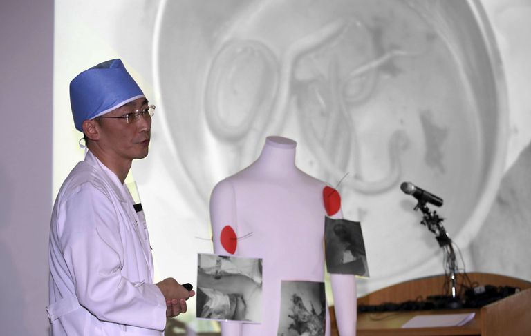 Lõuna-Korea kirurg Lee Cook-jong selgitamas, millised parassidid olid Põhja-Korea sõduri seedekulglas ja millised olid ta tulistamisvigastused