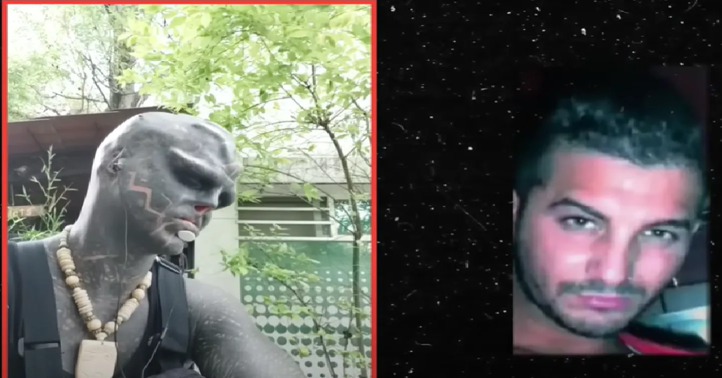 Mees plaanib järgmiseks lasta ühe jala amputeerida