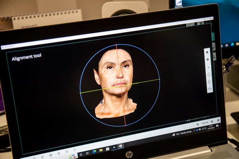 Система 3D LifeViz Infinity объединяет в одном аппарате возможность провести анализ кожи лица и 3D-визуализацию.