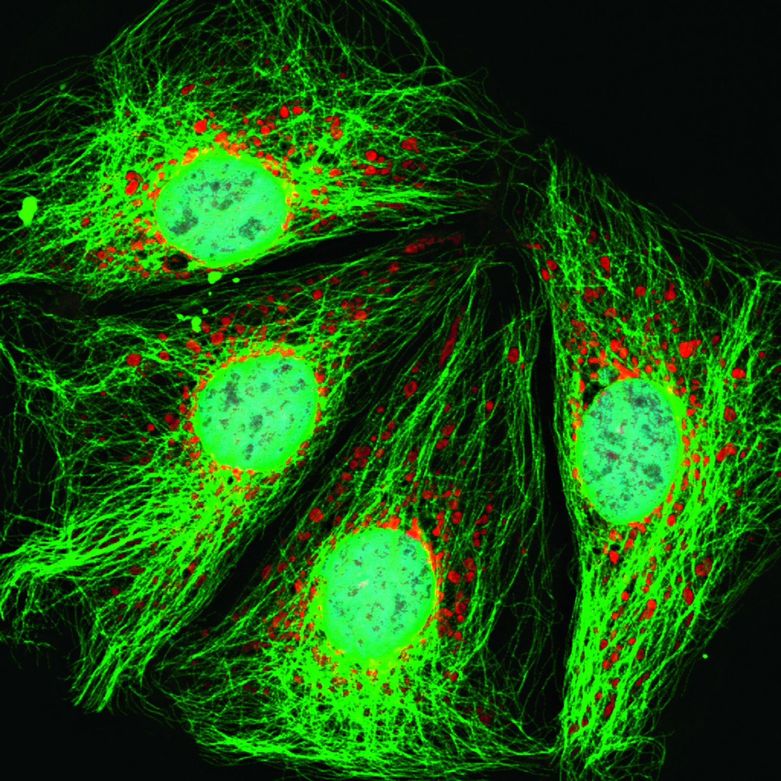 Jämesoole vähirakud  pärast võihappega inkubeerimist. Punasega on värvitud vähirakkude mitokondrid, rohelisega aga rakkude sisetoese moodustav tsütoskelett ja helesinisega rakkude tuumad
