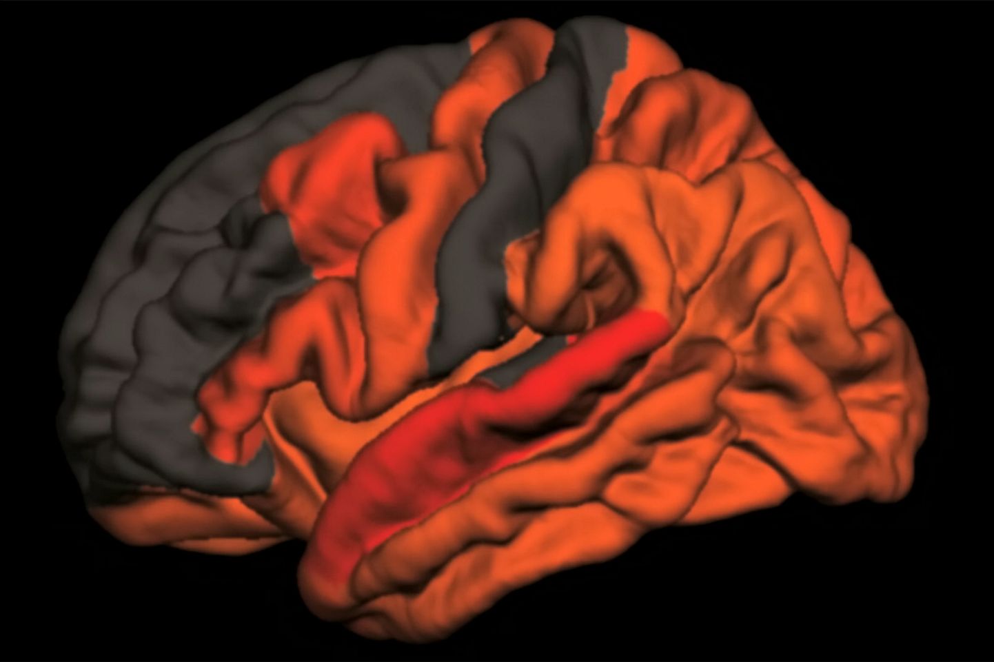 Varasemates uuringutes on leitud, et päeval sageli tukastamine võib viidata Alzheimeri tõvele. Unisus tulebki aeglaste ajulainete vähenemisest ja sügava une lühenemisest. Punase ja oranžiga on joonisel märgitud ajupiirkonnad, kus aeglaste ajulainete vähenemise ja amüloidbeeta kogunemise seos oli kõige märgatavam.