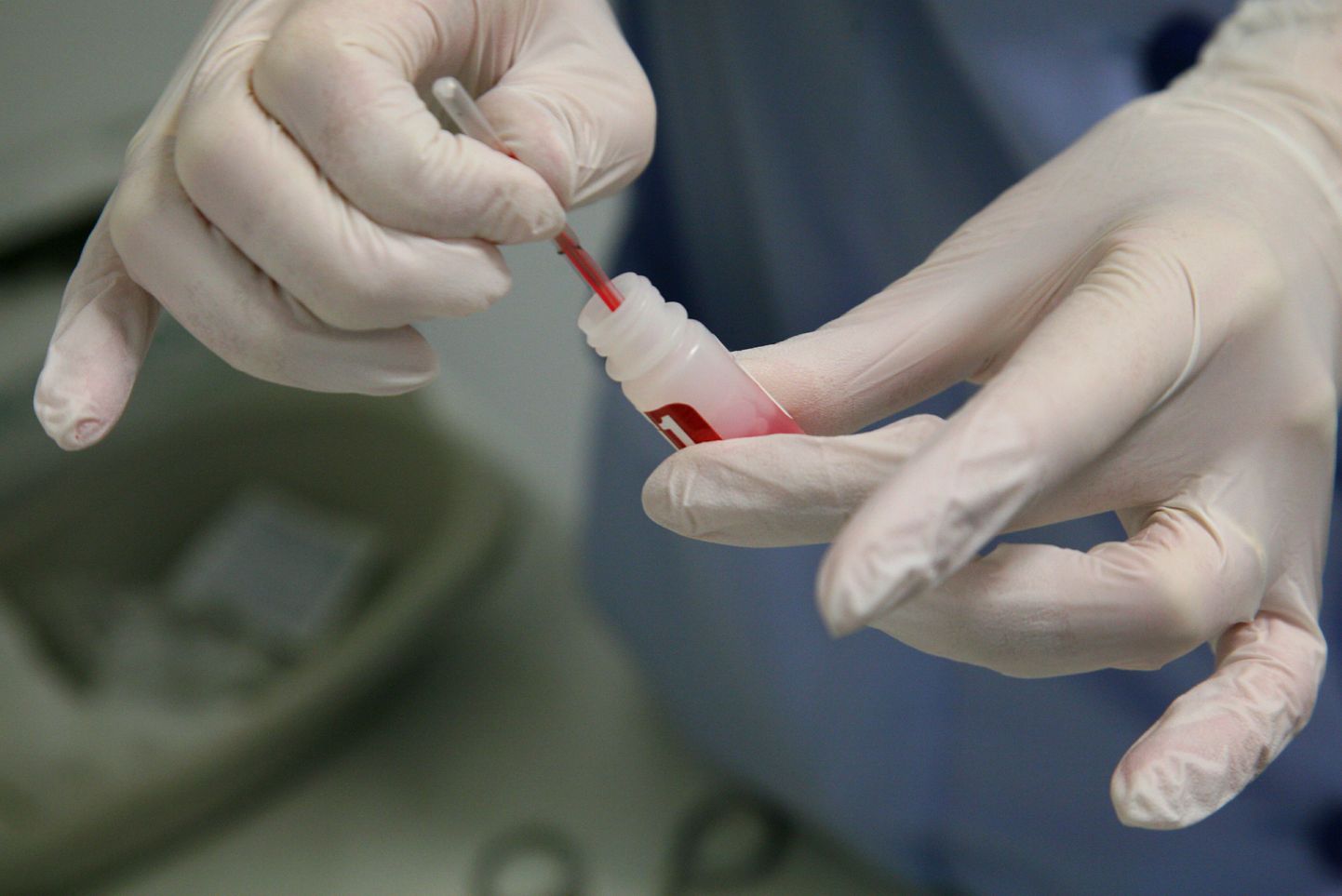Aidsi kabinet Pärnu haiglas. HIVi kiirtesti komplekt. Pildil vere lisamine testlahusesse.