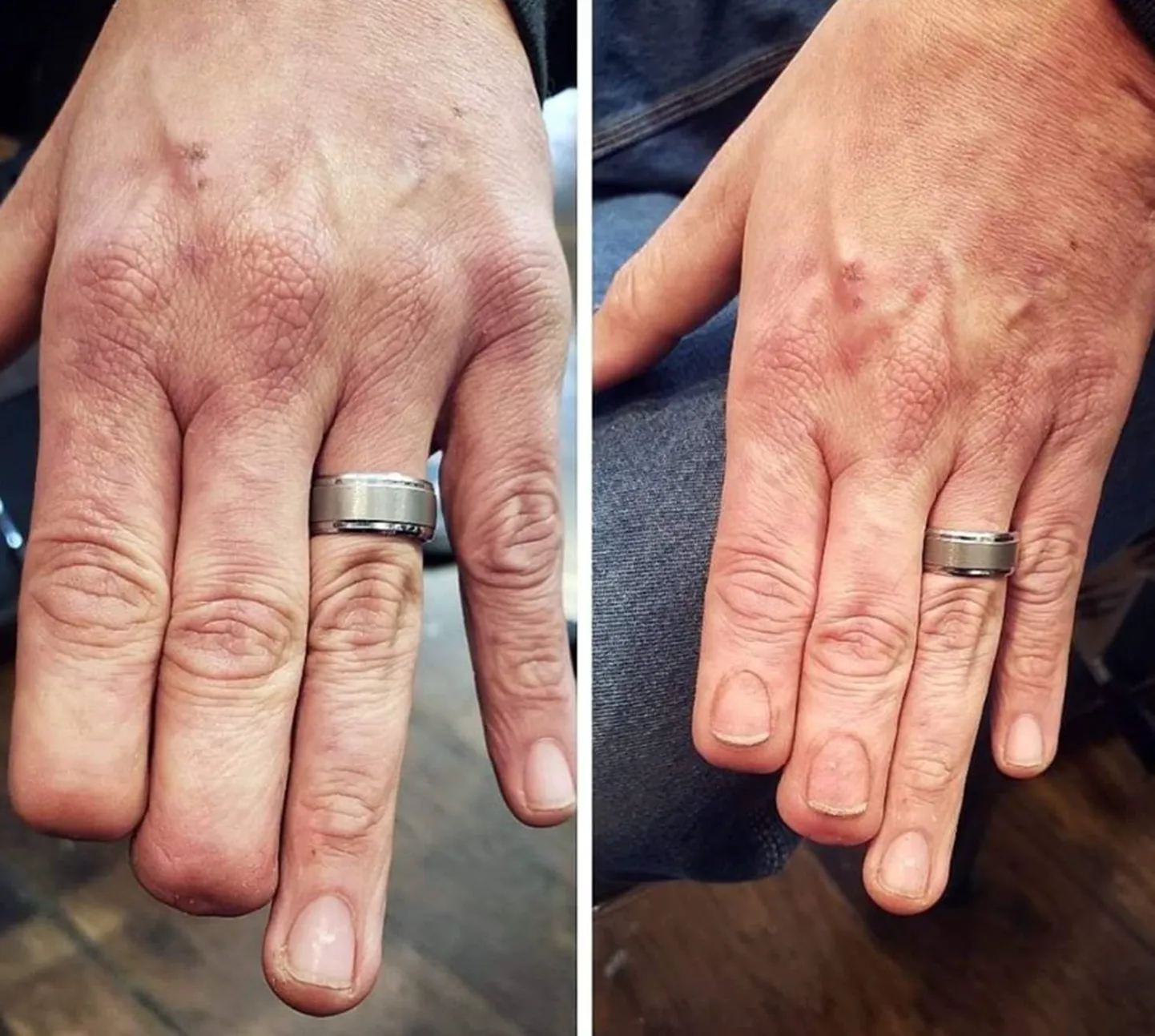 Enne ja pärast. Paremapoolsel pildil võib näha, et kaks sõrme on küll lühemad, aga küüned nendel nagu päris.