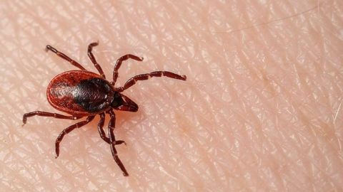 To the ER With a Tick Bite or Not? The Golden Rules You Need to Know for Every Tick Bite