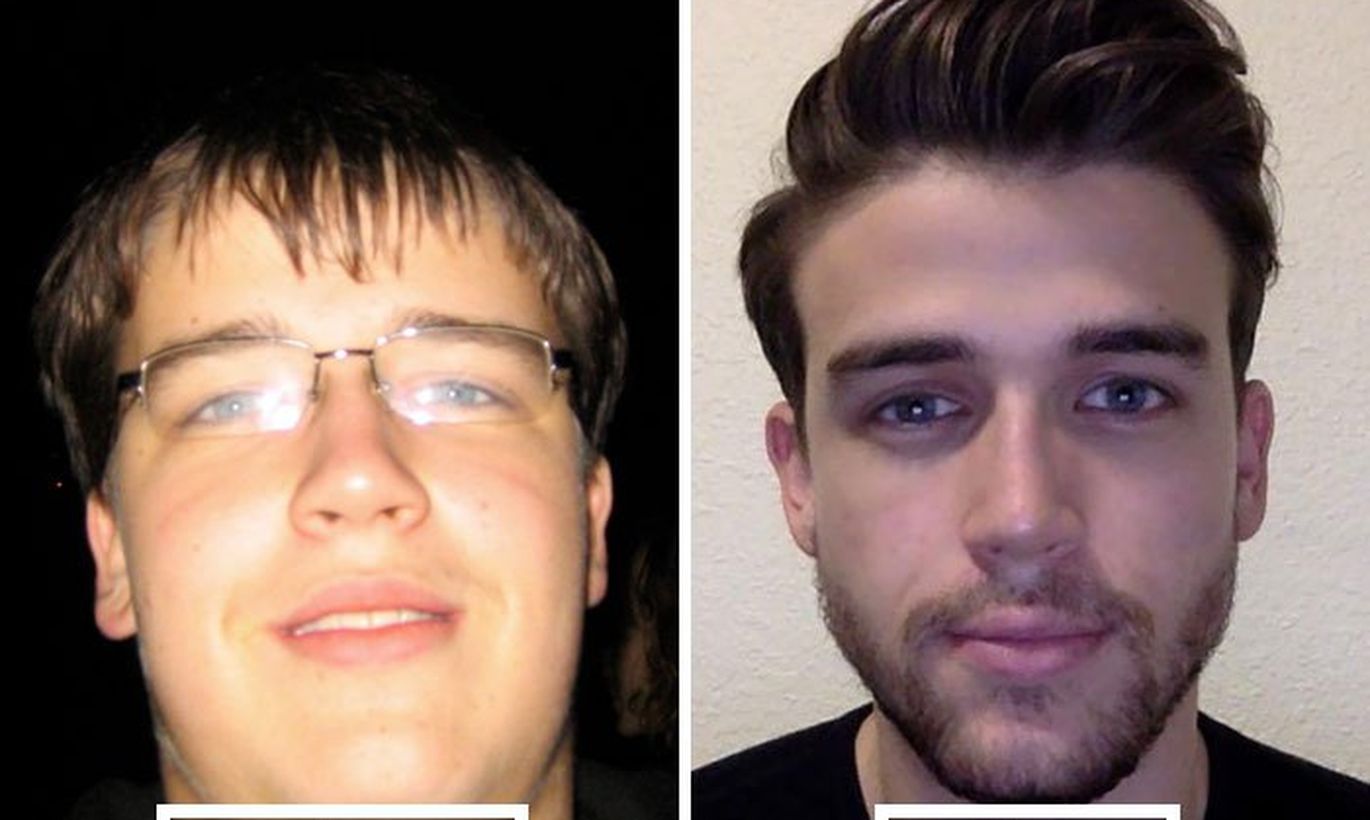 Изменился в лице когда понял. Изменение лица. Лицо до похудения. Парень до и после. Лица людей до и после похудения.