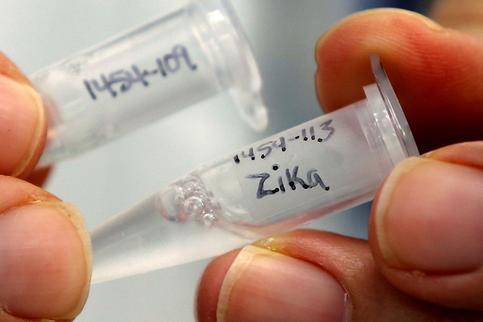 Tartu teadlased on koostöös Helsingi kolleegidega jõudnud väga lähedale Zika vaktsiinile. Pilt on illustreeriv.