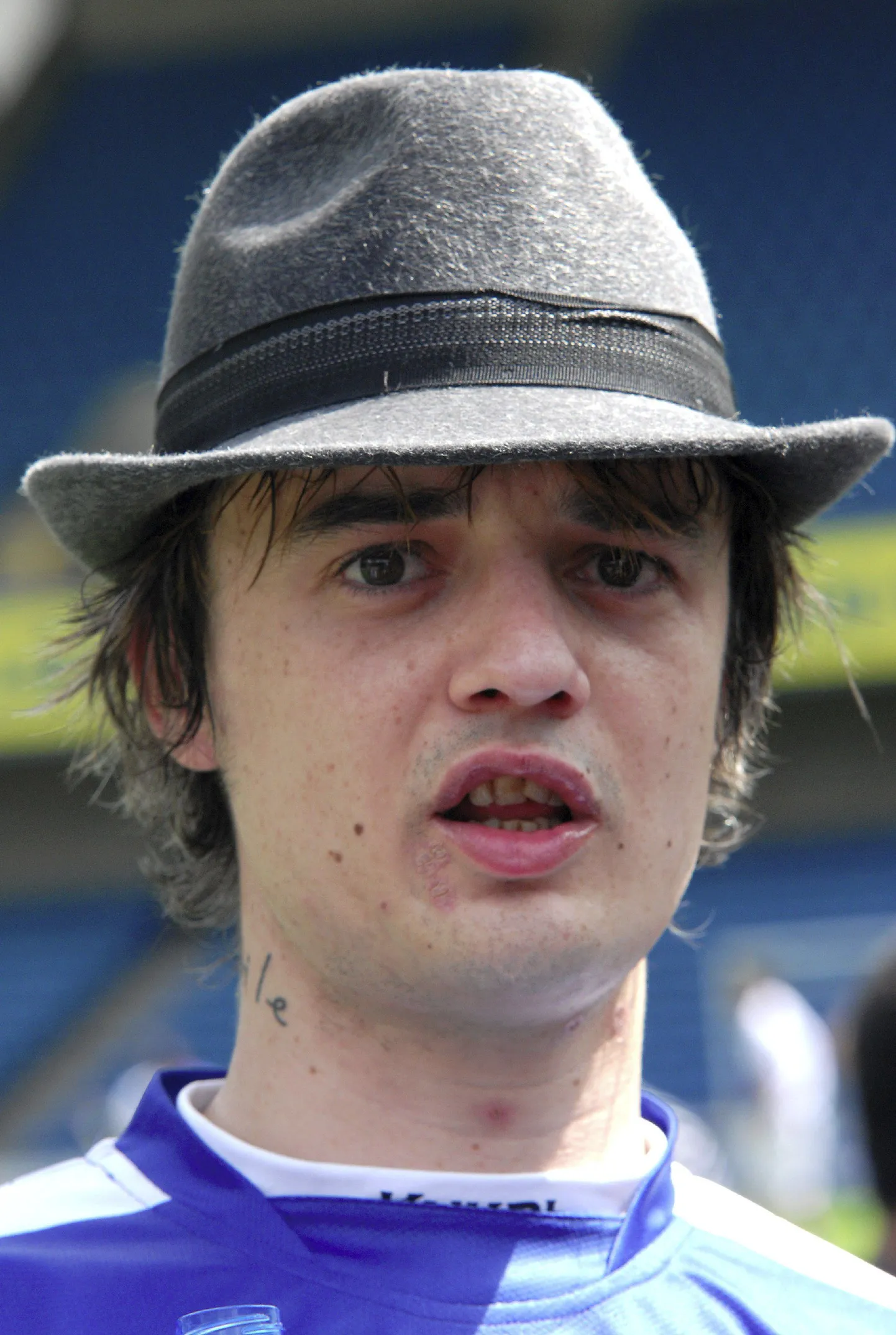 Pete Doherty