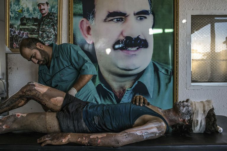 Brasiilia fotograafi Mauricio Lima foto väljaandele New York Times «ISISe võitlejat ravitatakse kurdi haiglas»