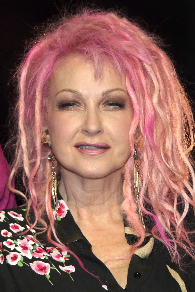Cyndi Lauper.