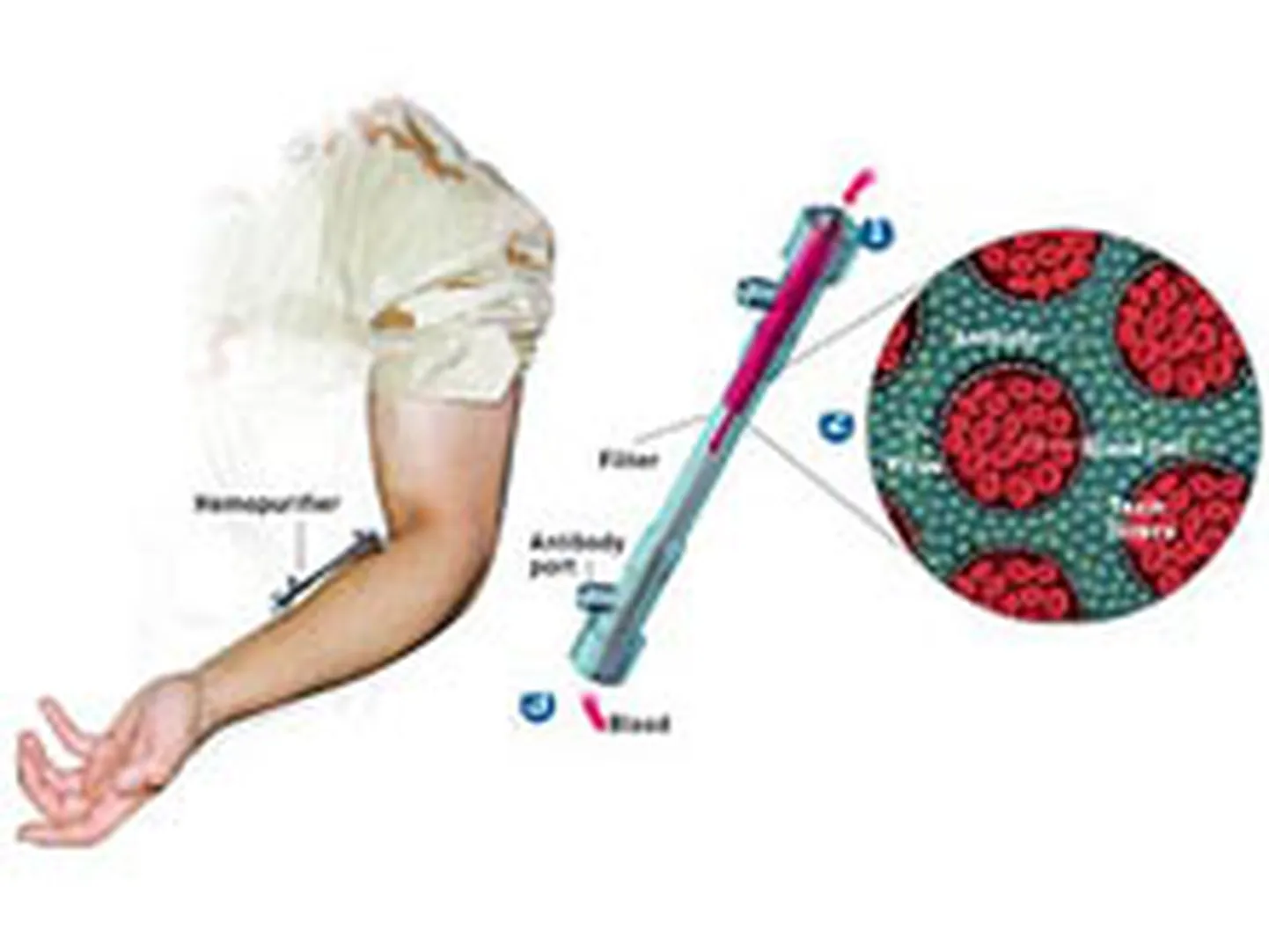 Aethlon Medical Study Links Long COVID to Extracellular Vesicles