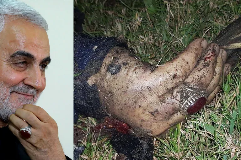 Iraani kindralmajor Qassem Soleimani (vasakul) ja ta käsi, milles oleva sõrmuse järgi ta pärast USA raketirünnakut kindlaks tehti.
