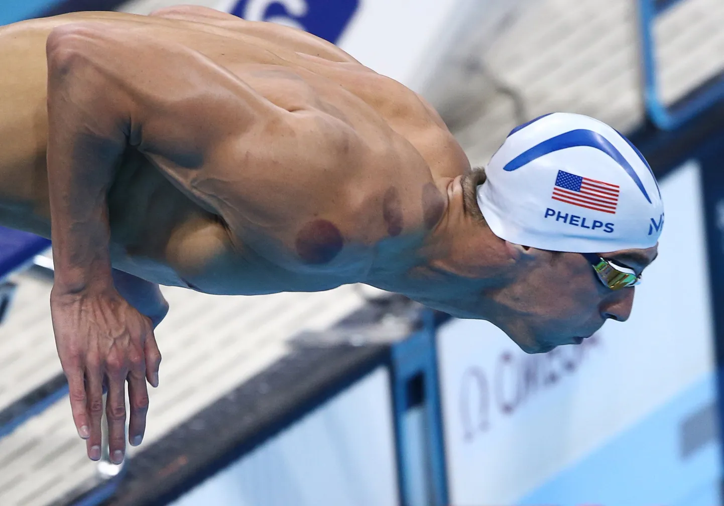 Kuputeraapia Michael Phelpsi õlgadel