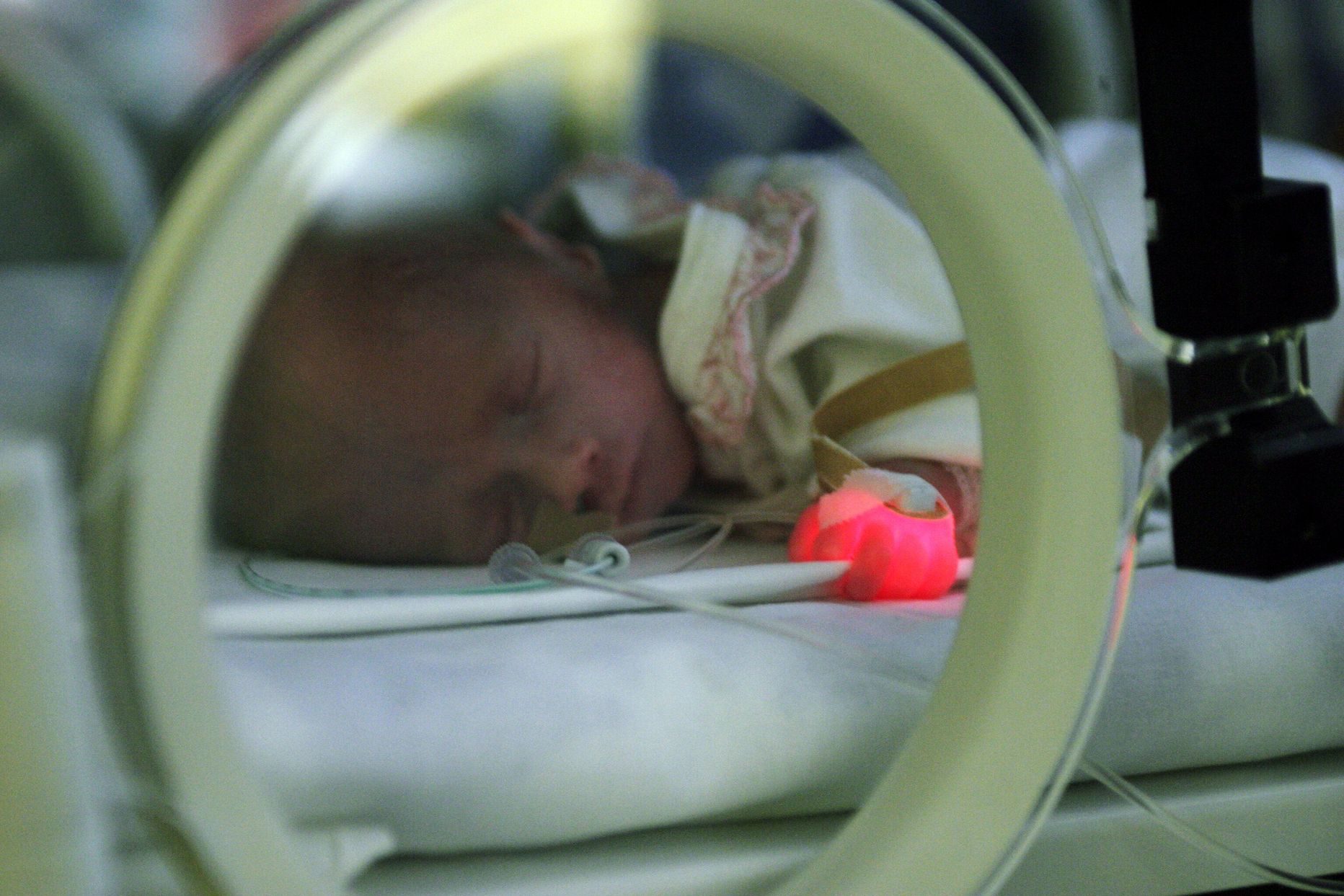 Pildil enneaegne beebi Tartu Ülikooli kliinikumi lastekliiniku intensiivraviosakonnas.