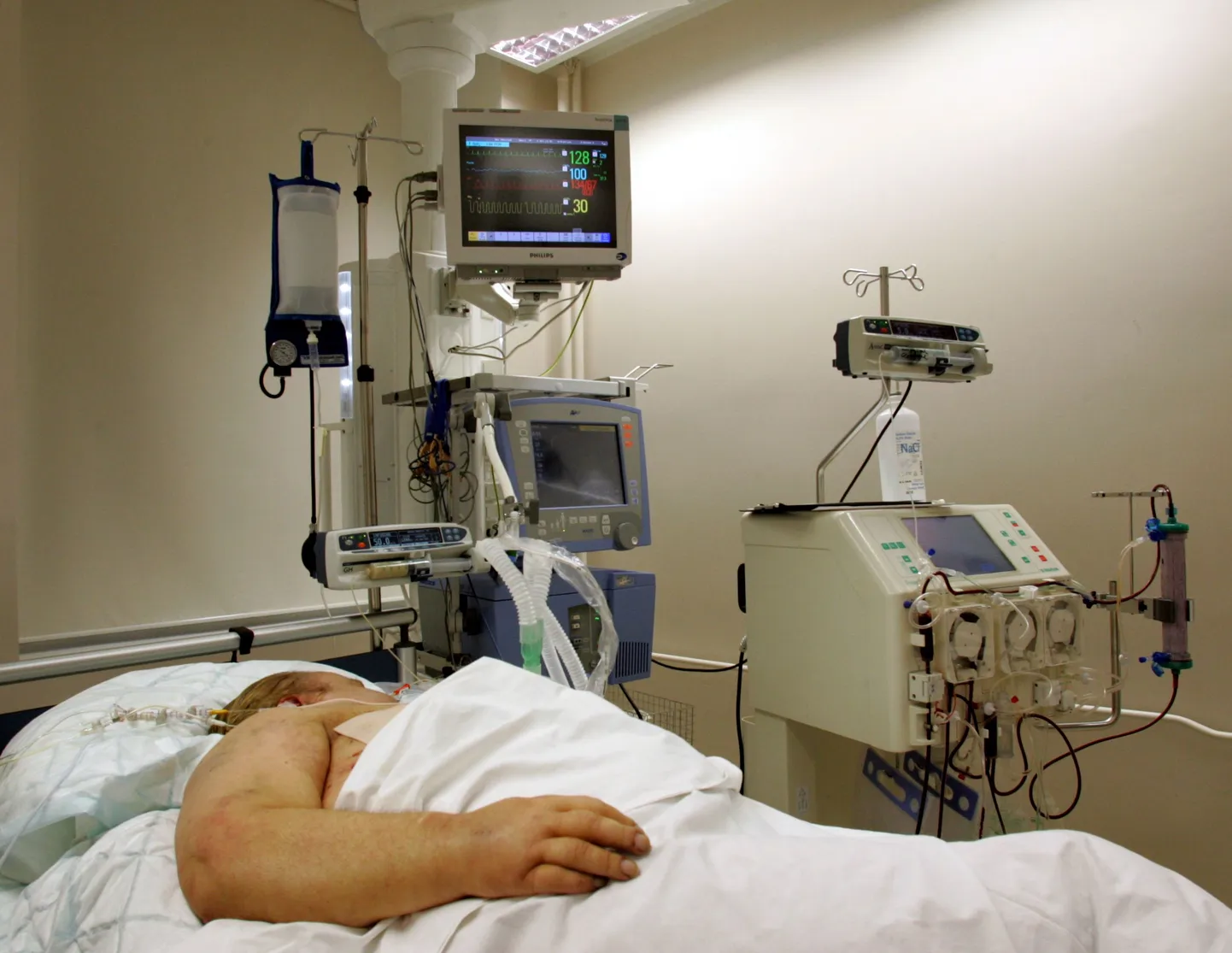 Глава объединения пациентов Эстонии Пилле Ильвес назвала новую схему оплаты больничного совершенно безответственной.