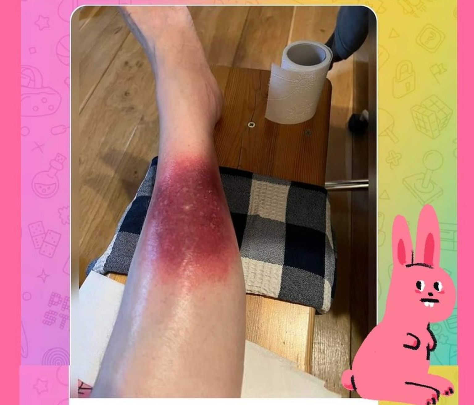 В социальной сети женщина рассказала, как лечит сыпь на ноге с помощью MMS.