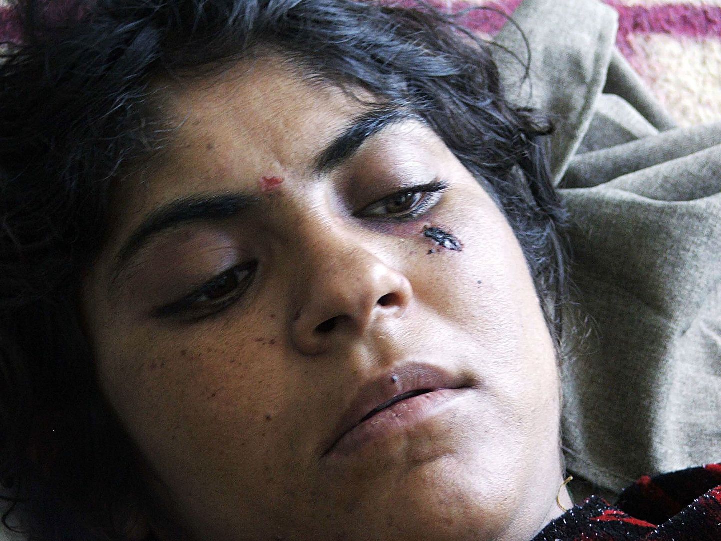 USA õhurünnaku käigus haavata saanud naine.