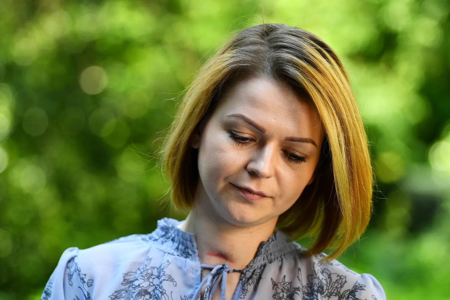 Sergeja Skripaļa meita Jūlija pēc iznākšanas no slimnīcas