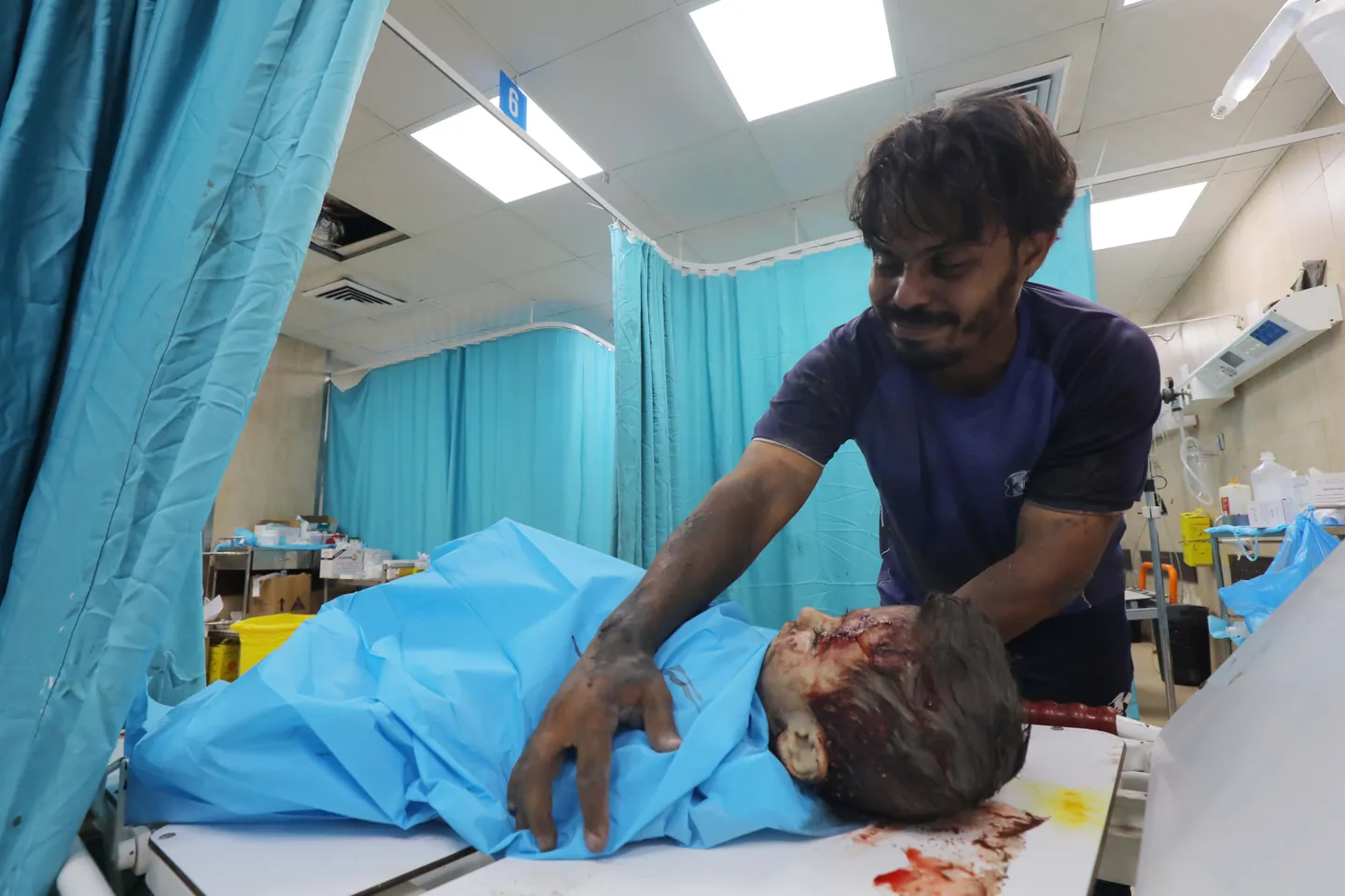 Vigastatud inimeste toimetamine Gaza Al-Aqsa haiglasse.