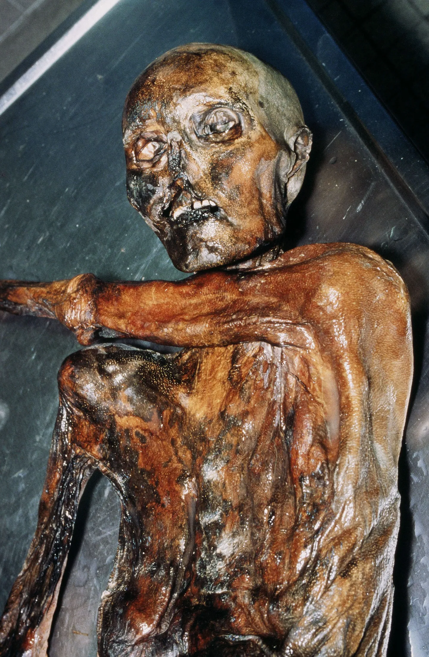 Jäämees Ötzi muumia