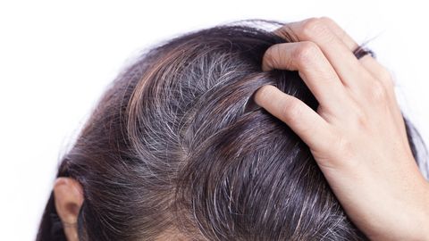 Levinud põhjused, miks muutuvad juuksed varakult halliks