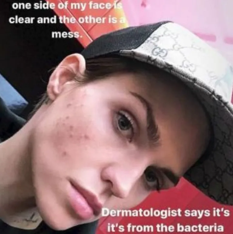 Ruby Rose