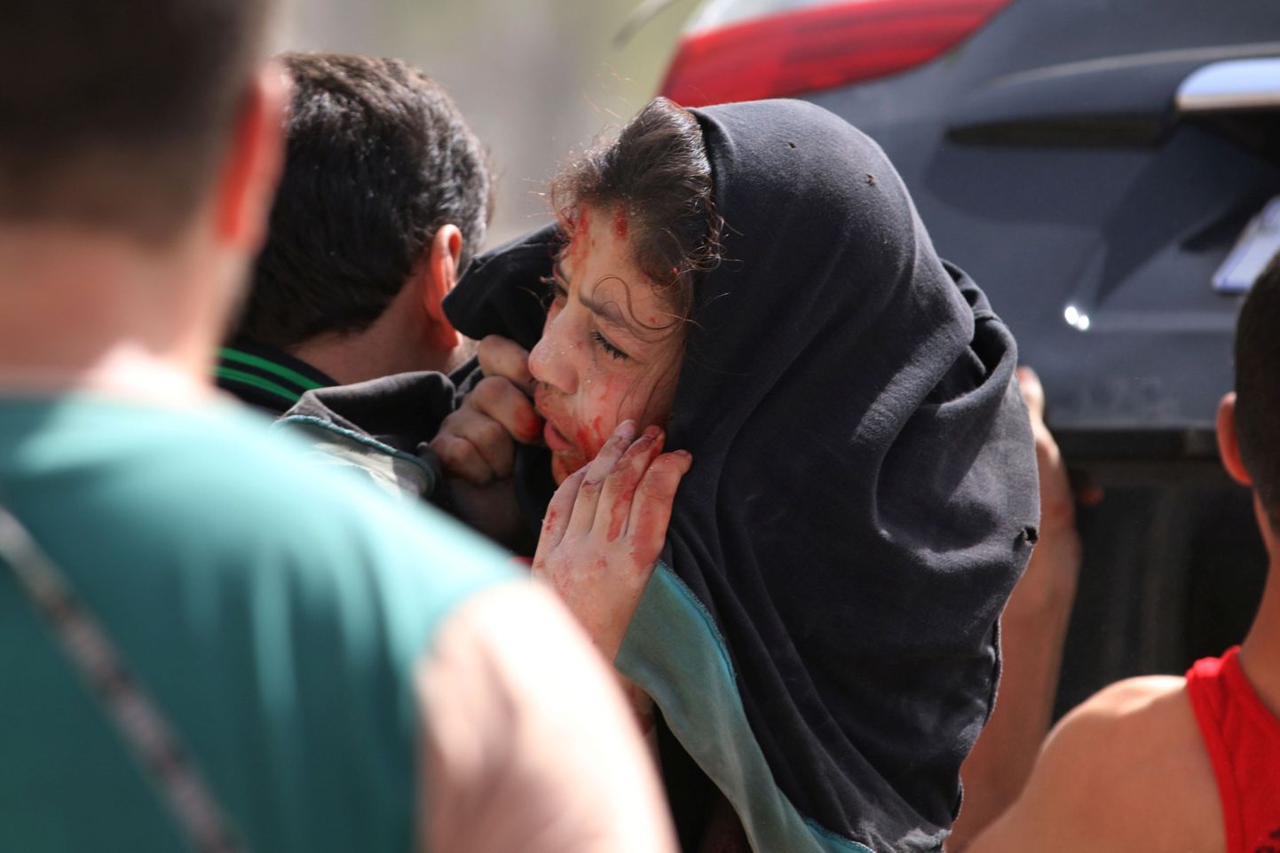 Mees kannab kolmapäeval, 21. septembril Aleppo lähedal toimunud õhurünnakus viga saanud tüdrukut.