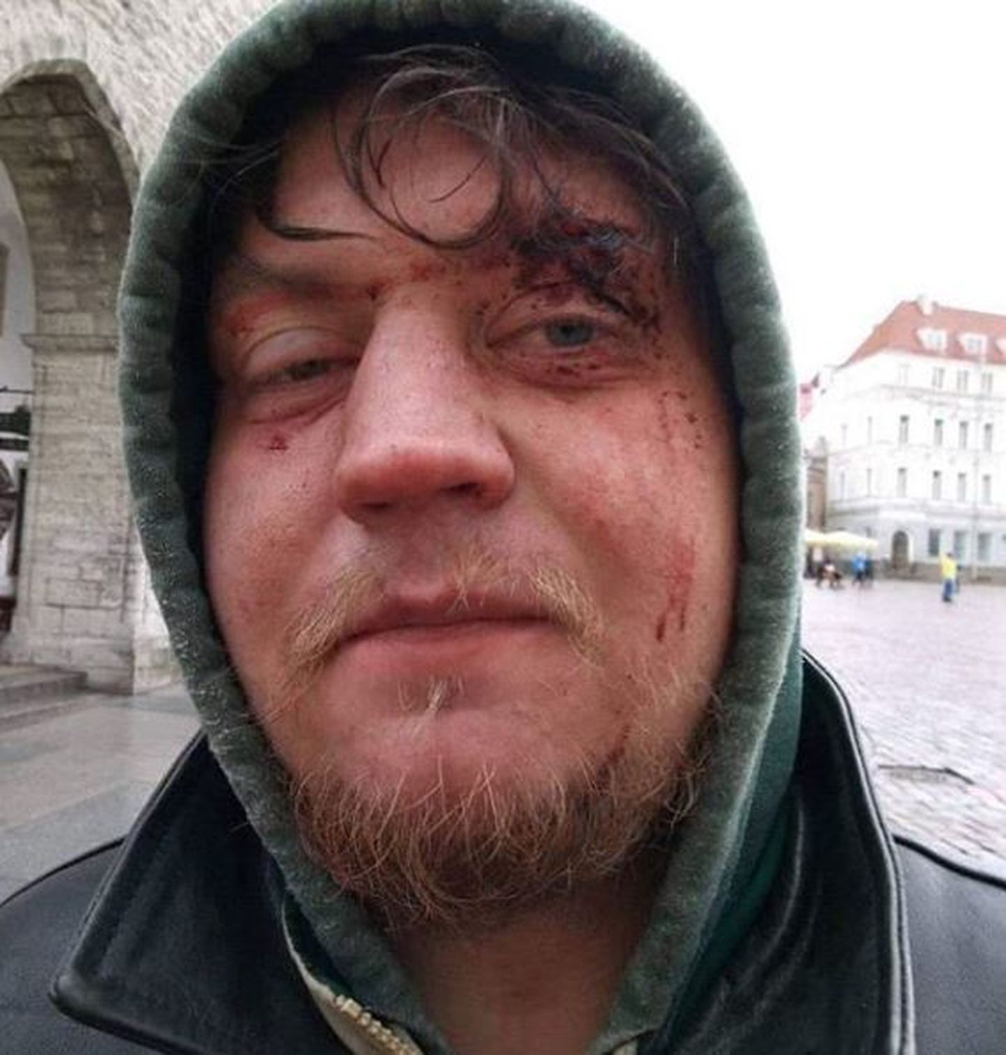 Олег Семенович после драки
