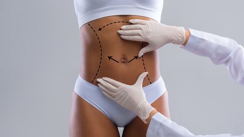 Arstid hoiatavad kosmeetiliste operatsioonide meditsiiniturismi ohtude eest: laastavad tagajärjed