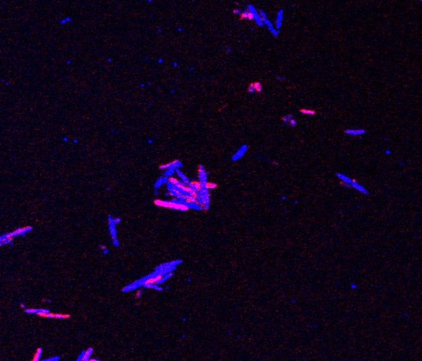 Teadlased suudavad nüüd uue meetodiga jälgida konkreetsete toitainete liikumist hiire seedekulgla mikrobioomis. Fotol on kujutatud teatud mikroobid (punasena) haaramas endasse rinnapiimas leiduvat tavalist toitainet sfinganiini. Sinised mikroobid ei ole seda haaranud.