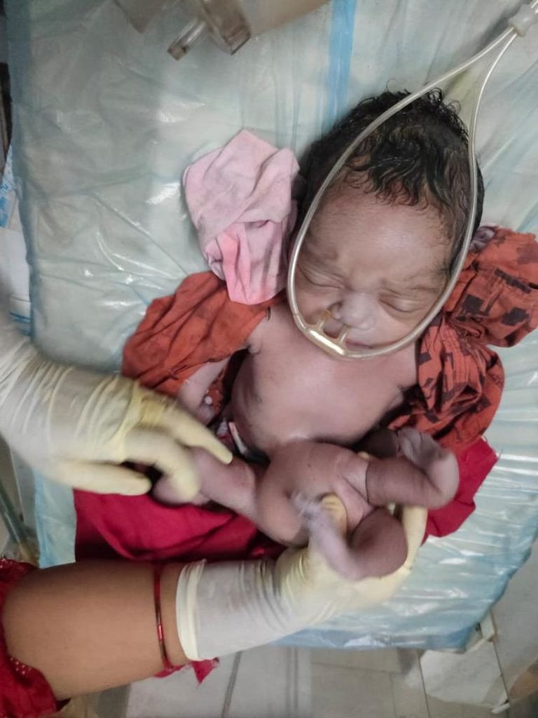 A baby has been born in India - with four extra limbs.The child was delivered over the weekend in Hardoi, in the north of the country. See SWNS story SWOCbaby. Footage and pictures show the baby with what appears to be an extra pair of arms and legs attached to its stomach.The child weighed 6.5lbs and was born at the Shahabad Community Health Centre, in the state of Uttar Pradesh.Mum Kareena, whose surname has not been given, was admitted to the hospital after experiencing labour pains on Saturday (2/7) and gave birth soon after.Both mother and child are said to be healthy and doing well.And reports say people have flocked to see the child after the news spread across the area, and the tot was hailed a "miracle of nature".Others have apparently suggested it could be the reincarnation of a goddess.