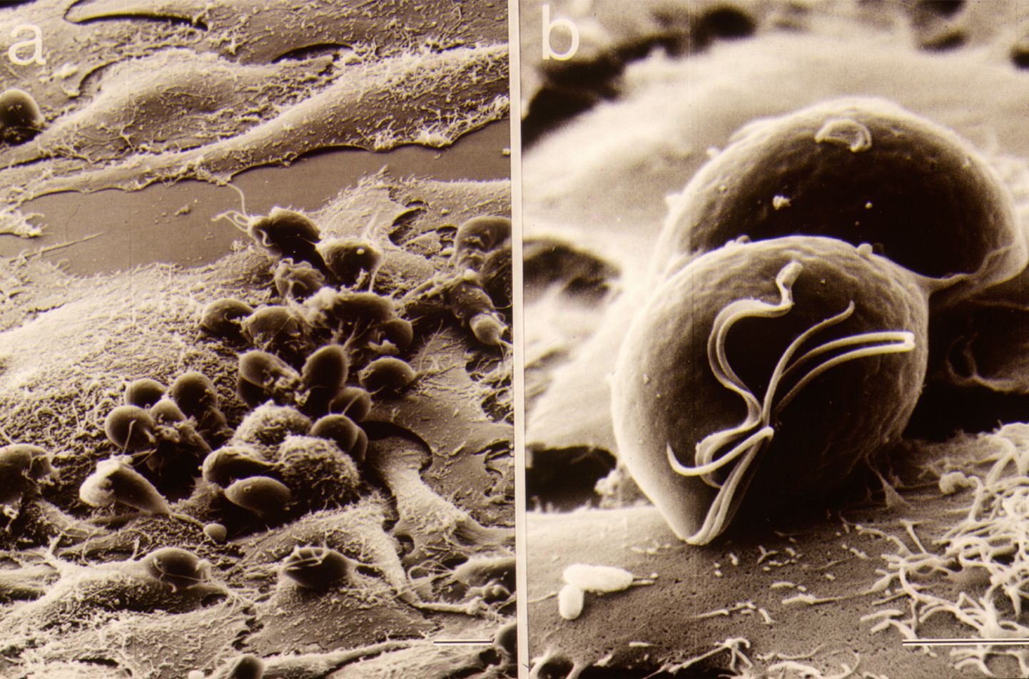 Trichomonas vaginalis под микроскопом.