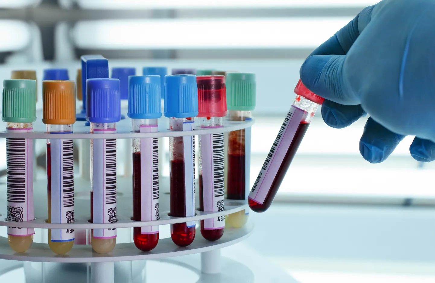 Kliinilisi uuringuid tehakse veel teistegi peptiidi põhiste vaktsiinikandidaatidega nagu EpiVAcCorona (Viroloogia instituut Vector, Venemaa) ja CoVac-1 (Tübingeni ülikooli haigla).