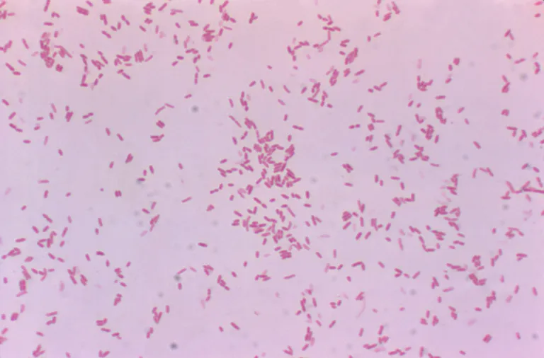 Aeromonas hydrophila