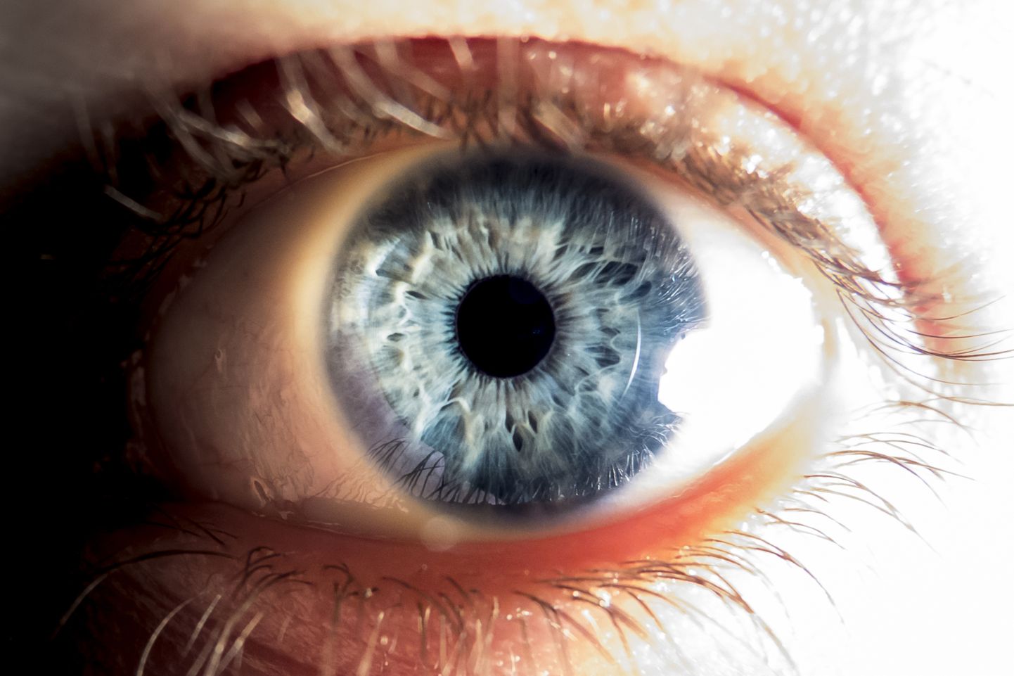 Laserosutisse vaatamine võib pöördumatult kahjustada silma fotoretseptoreid, mis toodavad nägemisnärvi minevaid signaale.