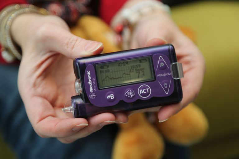 Insuliinipumba ekraanilt on võimalik jälgida glükoosi näitusid reaalajas ning glükoositaseme muutuste graafikuid kogu ööpäeva jooksul. Samuti on võimalik näha, kuidas toitumine, kehaline koormus, ravimid ning eluviis veresuhkru taset mõjutavad.