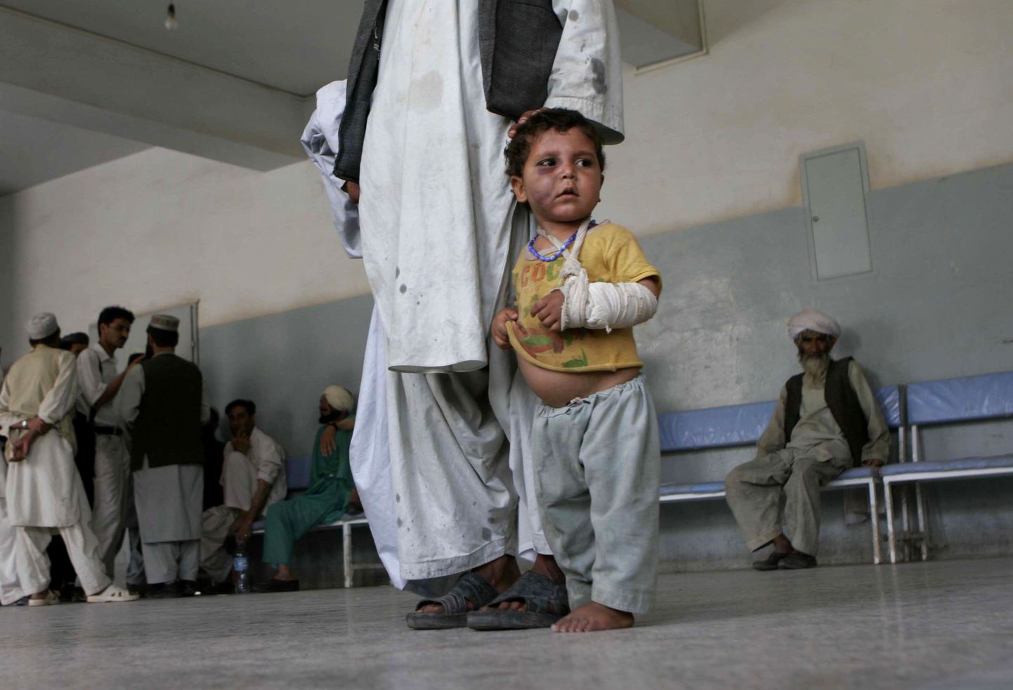 Haavatud afgaani poiss.