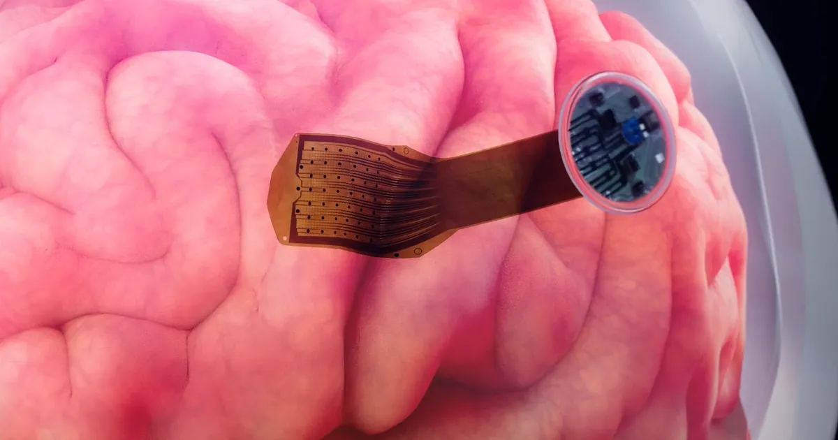 Au pus mai mulți electrozi în creier