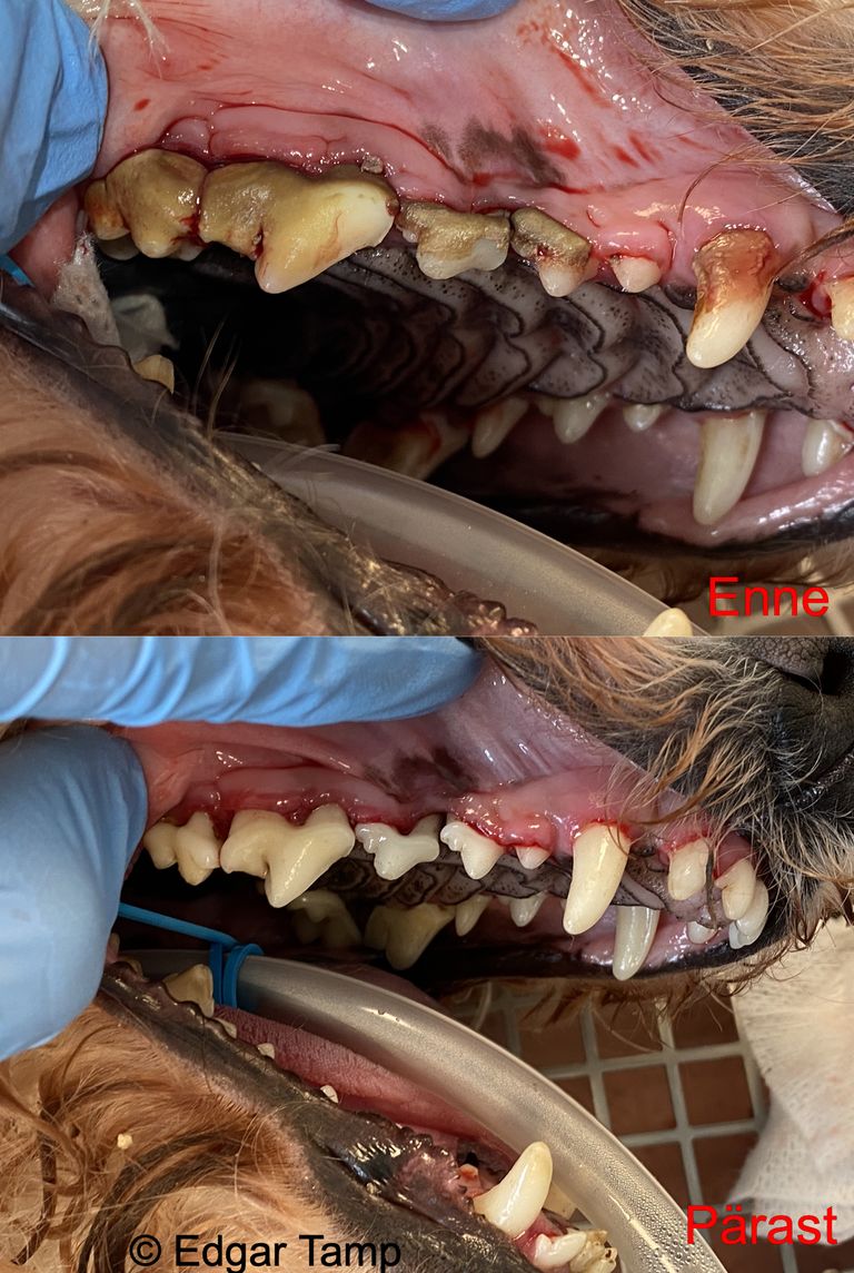 Vaatepilt enne ja pärast hambakatu eemaldamist.