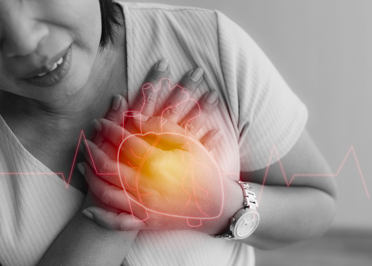 Südameinfarkt on südamelihase pöördumatu kahjustus, mille korral osa südamelihasest muutub elutuks ja hävib.