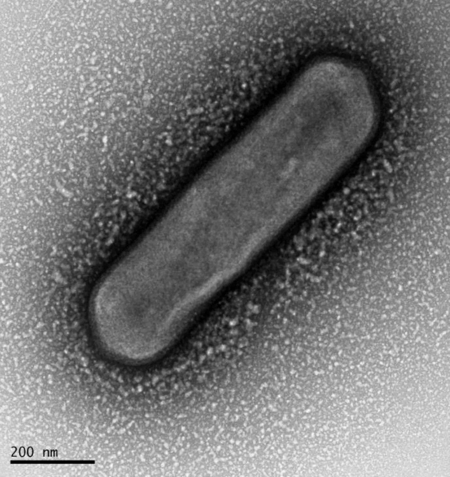 See organism suudab hapnikku toota ka valuseta. Nitrosopumilus maritimus elektronmikroskoobi fotol.