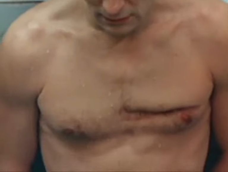 Кадр из фильма "Игла", где виден шрам на груди Петра Мамонова